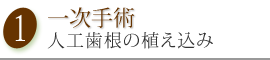 一次手術　人工歯根の植え込み