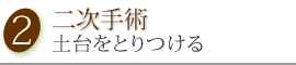 二次手術　土台をとりつける